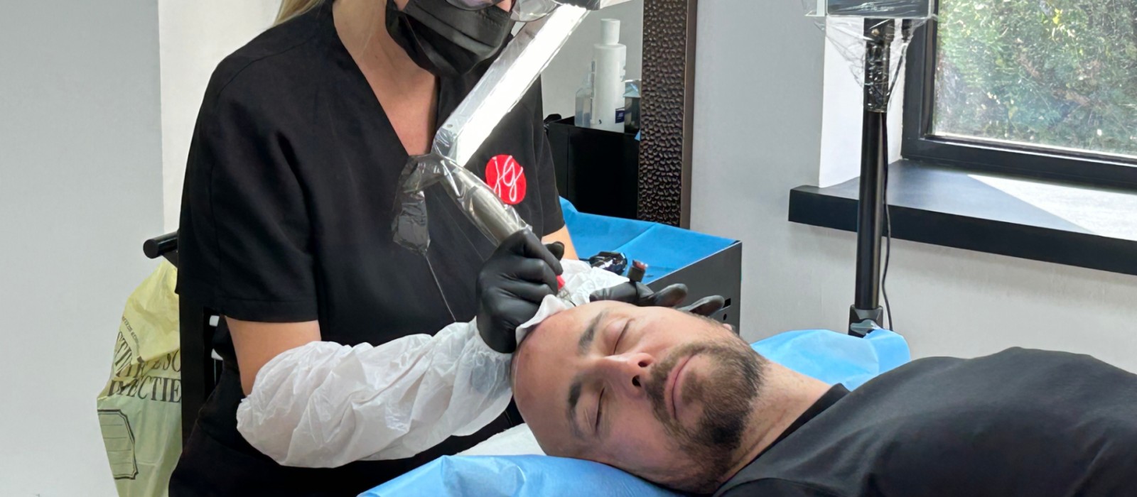 La dermopigmentation capillaire pour masquer les alopécies