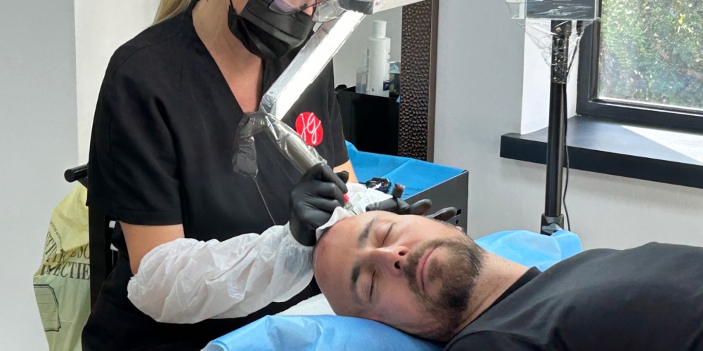 La dermopigmentation capillaire pour masquer les alopécies