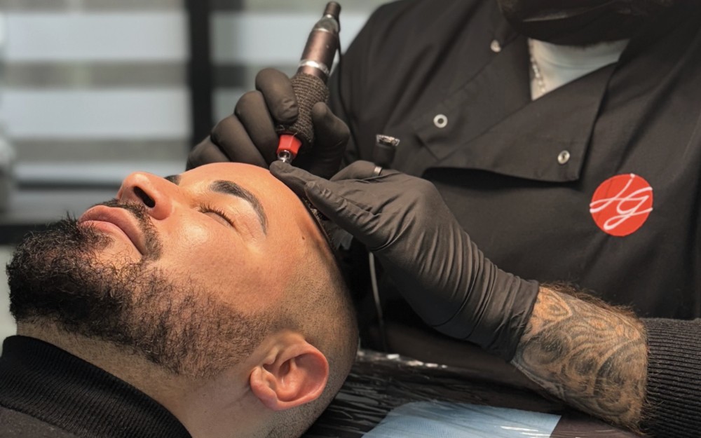 Séance de Tricopigmentation sur homme pour un effet de crâne rasé au Centre Jennifer Glomaud à Lyon