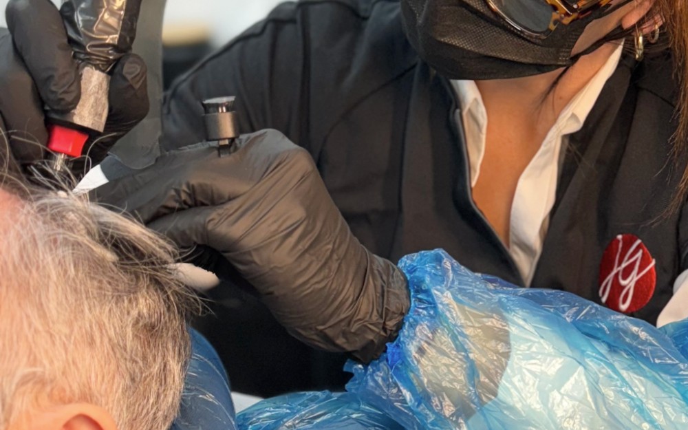 Séance de Tricopigmentation sur homme pour un effet densité capillaire au Centre Jennifer Glomaud à Lyon