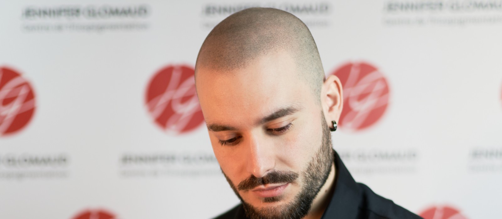 Le tatouage pour cheveux, la nouvelle mode masculine contre la calvitie
