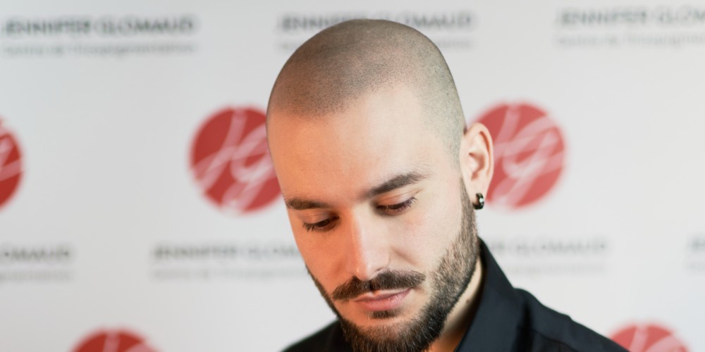Le tatouage pour cheveux, la nouvelle mode masculine contre la calvitie
